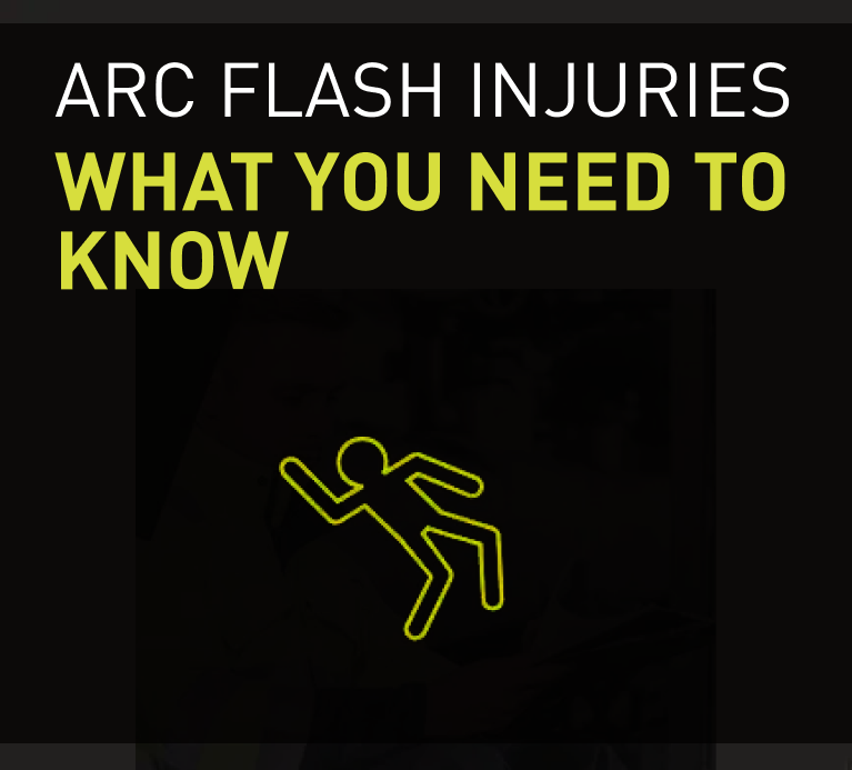 Information on arc flash injuries